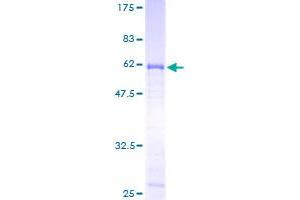 SFRP1 Protein (AA 1-314) (GST tag)