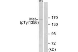 Western blot analysis of extracts from NIH-3T3 cells, using Met (Phospho-Tyr1356) Antibody. (c-MET Antikörper  (pTyr1356))