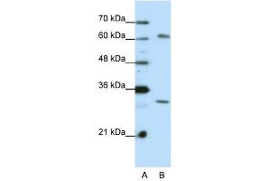 AUH antibody used at 0. (AUH Antikörper  (C-Term))