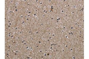 The image on the left is immunohistochemistry of paraffin-embedded Human brain tissue using ABIN7130674(PPAT Antibody) at dilution 1/50, on the right is treated with fusion protein.