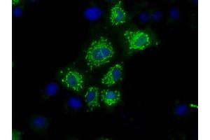 Anti-NIT1 mouse monoclonal antibody (ABIN2453350) immunofluorescent staining of COS7 cells transiently transfected by pCMV6-ENTRY NIT1 (RC211519). (Nitrilase 1 Antikörper)