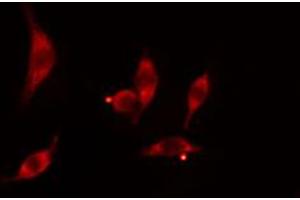 ABIN6274473 staining HT29 cells by IF/ICC. (ITPKC Antikörper  (N-Term))