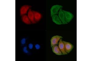 ABIN6265700 and ABIN6266665 staining Hela cells by IF/ICC.