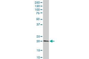 ESM1 MaxPab rabbit polyclonal antibody. (ESM1 Antikörper  (AA 1-184))