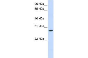 Western Blotting (WB) image for anti-Hydroxysteroid (11-Beta) Dehydrogenase 1 (HSD11B1) (N-Term) antibody (ABIN2773867)