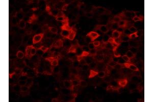 Immunofluorescence (IF) image for anti-Fatty Acid Synthase (FASN) (AA 2462-2511) antibody (ABIN7448964)