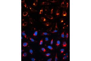 Immunofluorescence analysis of U2OS cells using Cytokeratin 18 (KRT18) antibody (ABIN7268098) at dilution of 1:100. (Cytokeratin 18 Antikörper  (AA 127-430))