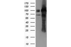 Western Blotting (WB) image for anti-Pseudouridylate Synthase 7 Homolog (PUS7) antibody (ABIN1500514) (PUS7 Antikörper)