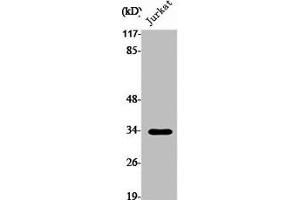 Western Blot analysis of Jurkat cells using Pitx1 Polyclonal Antibody (PITX1 Antikörper  (Internal Region))