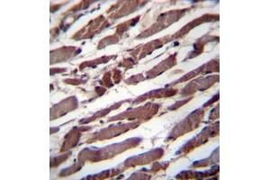 Formalin fixed, paraffin embedded human skeletal muscle stained with PUS1 Antibody (C-term) followed by peroxidase conjugation of the secondary antibody and DAB staining (PUS1 Antikörper  (C-Term))