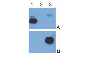 IgG κ light chain (1), IgG λ light chain (2) and IgG Fc fragment (3) purified from human serum were analysed by Western blotting with MEM-09 antibody against IgG κ light chain (A) and EM-07 antibody against IgG Fc fragment (B). (Maus anti-Human IgG Fc (Fc Region) Antikörper (FITC))