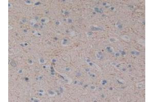 IHC-P analysis of Human Brain Tissue, with DAB staining. (Substance P Antikörper)