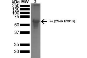 SDS-PAGE of ~67 kDa Human Tau Protein 2N4R P301S Pre-formed Fibrils (ABIN6929397, ABIN6929398 and ABIN6929399).