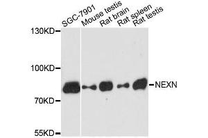 Western blot analysis of extracts of various cell lines, using NEXN antibody. (NEXN Antikörper  (AA 516-675))