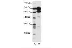 Image no. 1 for anti-Zinc Finger Protein 76 (Expressed in Testis) (ZNF76) (N-Term) antibody (ABIN202772) (ZNF76 Antikörper  (N-Term))
