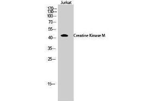 Western Blotting (WB) image for anti-Creatine Kinase, Muscle (CKM) (N-Term) antibody (ABIN3184074)