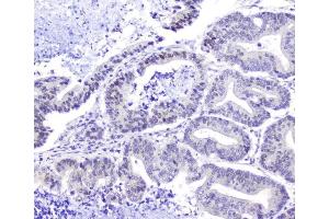 IHC analysis of Hsp105 using anti-Hsp105 antibody (ABIN5693036). (HSPH1 Antikörper  (AA 653-858))
