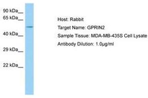 Image no. 1 for anti-G Protein Regulated Inducer of Neurite Outgrowth 2 (GPRIN2) (AA 21-70) antibody (ABIN6750104) (GPRIN2 Antikörper  (AA 21-70))