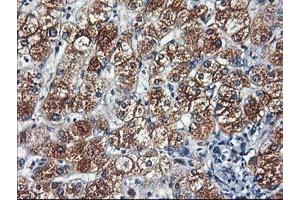 Immunohistochemical staining of paraffin-embedded Human liver tissue using anti-HARS2 mouse monoclonal antibody.