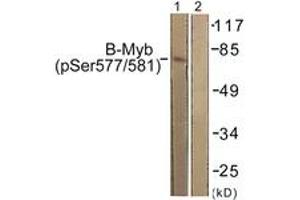 Western blot analysis of extracts from K562 cells, using B-Myb (Phospho-Ser577/581) Antibody. (MYBL2 Antikörper  (pSer577))