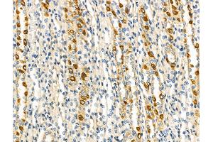 ABIN6263559 and ABIN6268825 at 1/100 staining Rat kidney tissue by IHC-P.