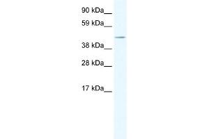 WB Suggested Anti-TAF7L Antibody Titration:  1. (TAF7L Antikörper  (Middle Region))