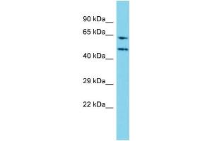Host: Rabbit Target Name: WDR85 Sample Type: Jurkat Whole Cell lysates Antibody Dilution: 1. (Diphthamide Biosynthesis 7 (DPH7) (N-Term) Antikörper)
