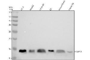 Western blot analysis of FKBP1A using anti-FKBP1A antibody (ABIN7604855).