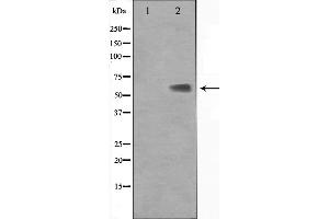 Western blot analysis on Jurkat cell lysate using KLF11 Antibody. (KLF11 Antikörper  (N-Term))