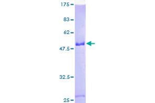 SNRNP70 Protein (AA 1-122) (GST tag)