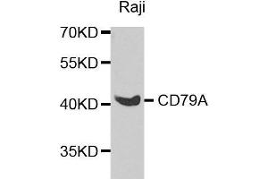 Western blot analysis of extracts of various cell lines, using CD79A antibody. (CD79a Antikörper  (AA 33-145))