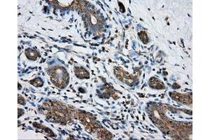 Immunohistochemical staining of paraffin-embedded breast tissue using anti-PRKAR2A mouse monoclonal antibody. (PRKAR2A Antikörper)
