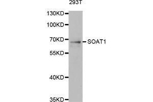 Western blot analysis of extracts of 293T cells, using SOAT1 antibody (ABIN5973731). (SOAT1 Antikörper)