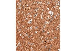 Immunohistochemical analysis of paraffin-embedded Human brain tissue using (ABIN6242238 and ABIN6577695) performed on the Leica® BOND RXm. (CD56 Antikörper  (C-Term))