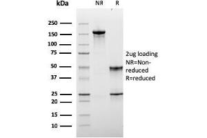 SDS-PAGE Analysis Purified Monospecific Mouse Monoclonal Antibody to LAG-3 (LAG3/3261). (LAG3 Antikörper)