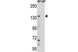 Western blot analysis of JMJD3 antibody and HeLa lysate (Kdm6b Antikörper  (AA 954-987))