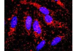 Proximity Ligation Analysis of protein-protein interactions between ACTN4 and CTNNB1. (alpha Actinin 4 Antikörper  (AA 1-911))