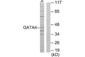 Western blot analysis of extracts from Jurkat cells, using GATA4 antibody. (GATA4 Antikörper  (Internal Region))