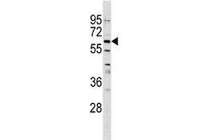 GPNMB antibody western blot analysis in CEM lysate. (Osteoactivin Antikörper  (AA 541-569))
