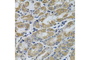 Immunohistochemistry of paraffin-embedded human stomach using PTK7 antibody. (PTK7 Antikörper)