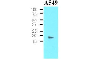 Western blot analysis: The Cell lysates of A549 (30ug) were resolved by SDS-PAGE, transferred to NC membrane and probed with anti-human PPP1R14A (1:500). (CPI-17 Antikörper)