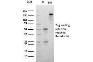 SDS-PAGE Analysis Purified C1QA Mouse Monoclonal Antibody (C1QA/2956). (C1QA Antikörper  (AA 104-237))