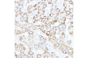 Immunohistochemistry of paraffin-embedded human liver using Kaiso/Kaiso/ZBTB33 Rabbit pAb  at dilution of 1:350 (40x lens). (ZBTB33 Antikörper  (AA 523-672))