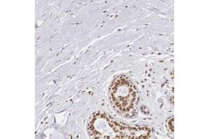 Immunohistochemical staining of human breast with ZNF275 polyclonal antibody  shows strong nuclear positivity in glandular cells. (ZNF275 Antikörper)