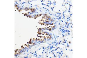 Immunohistochemistry of paraffin-embedded mouse lung using TMED3 antibody (ABIN7270944) at dilution of 1:100 (40x lens). (TMED3 Antikörper  (AA 24-180))