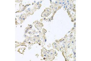 Immunohistochemistry of paraffin-embedded human lung using MMRN1 antibody at dilution of 1:100 (x40 lens).