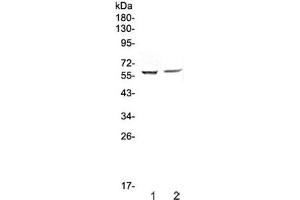 Western blot testing of human 1) HepG2 and 2) PANC-1 cell lysate with STAM1 antibody at 0. (STAM Antikörper)