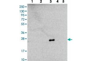 Western blot analysis of Lane 1: RT-4, Lane 2: U-251 MG, Lane 3: Human Plasma, Lane 4: Liver, Lane 5: Tonsil with NDUFB9 polyclonal antibody  at 1:250-1:500 dilution. (NDUFB9 Antikörper)