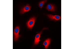 Immunofluorescent analysis of Cytokeratin 18 staining in MCF7 cells. (Cytokeratin 18 Antikörper  (N-Term))