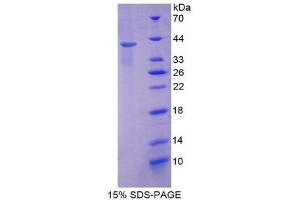 SDS-PAGE (SDS) image for Keratin 2 (KRT2) (AA 200-508) protein (His tag) (ABIN2125556)
